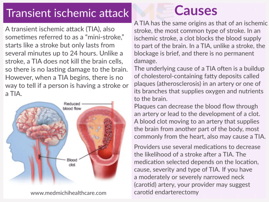 Transient ischemic attack​