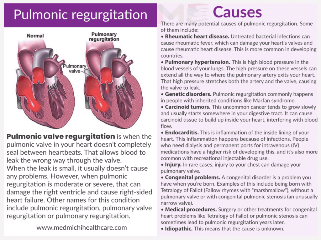 Pulmonary regurgitation ​