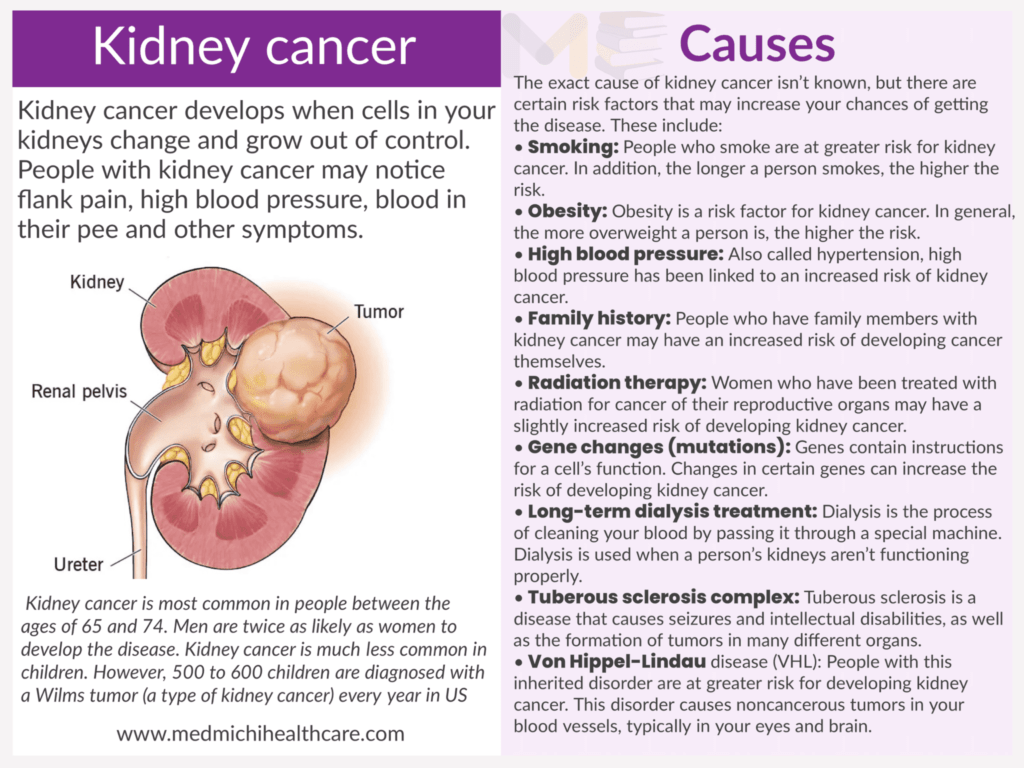 Kidney cancer 