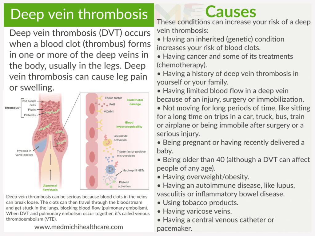 All Disease Causes Short Notes 20 Deep vein thrombosis 
