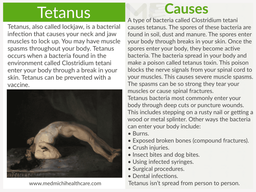 Tetanus 