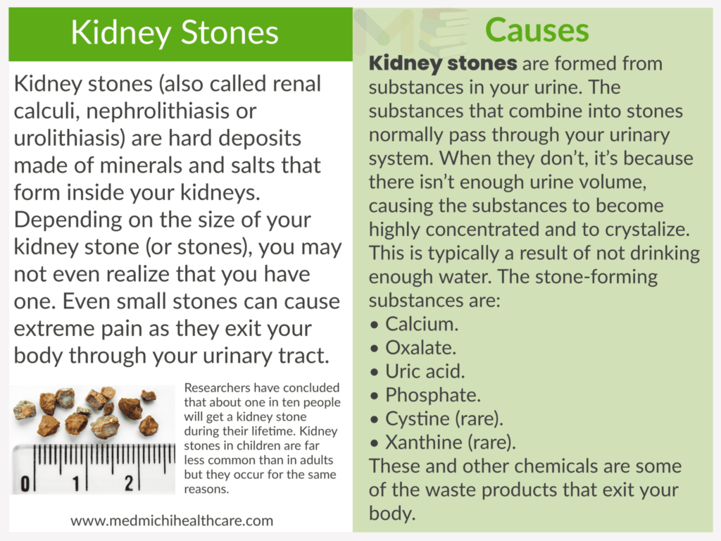 All Disease Causes Short Notes 11 Kidney stones