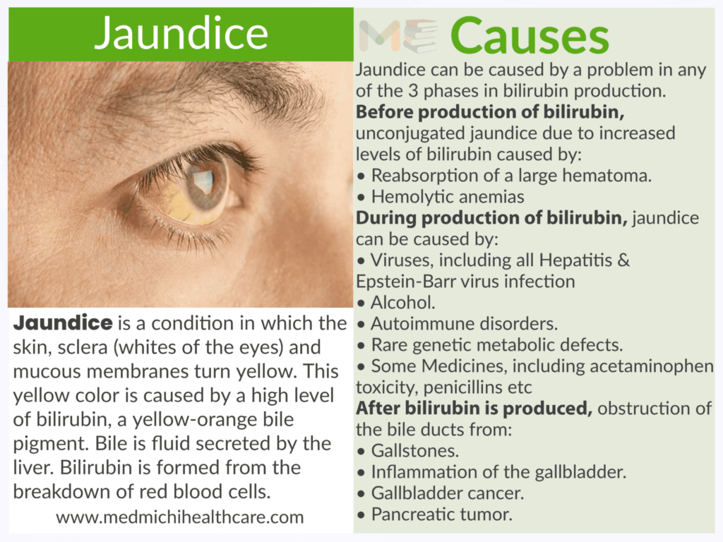 All Disease Causes Short Notes 4 fb1b3ae0 31c8 464f b683 d6e4a6eb5249 compressed