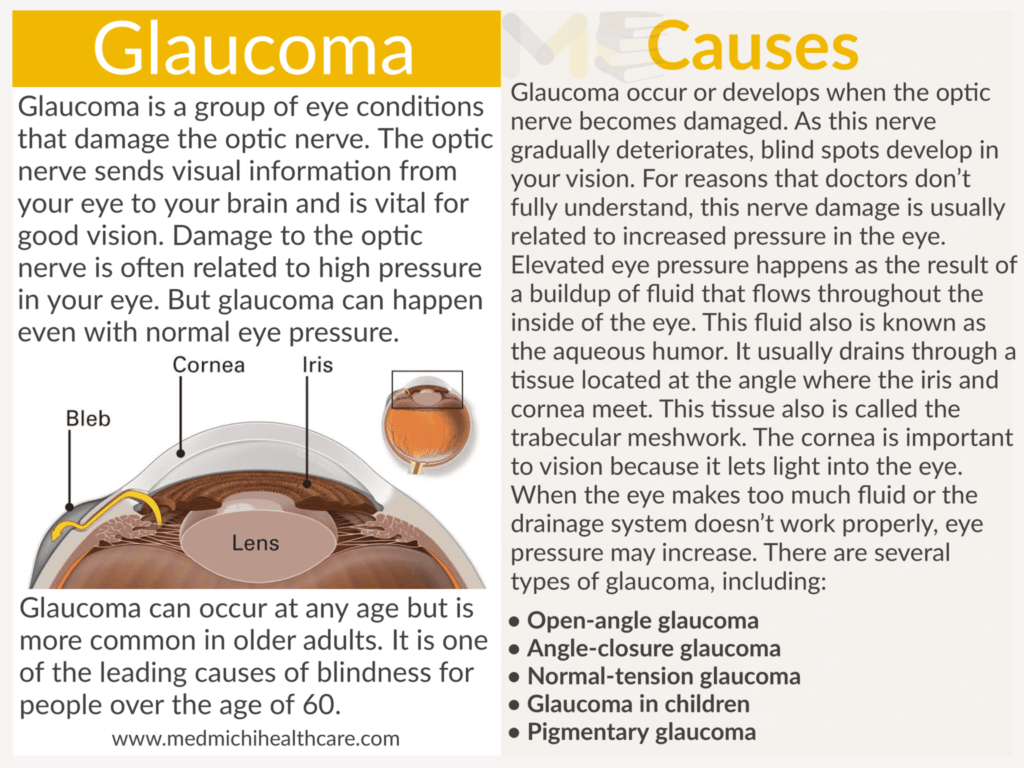 Glaucoma 