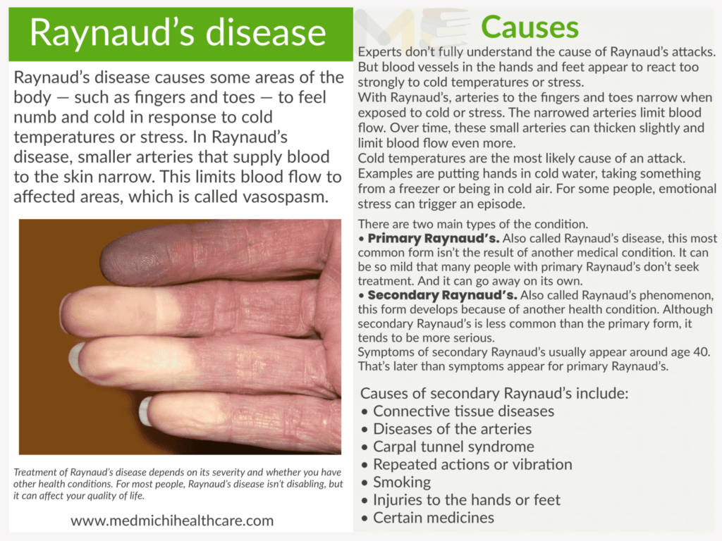Raynaud’s syndrome​