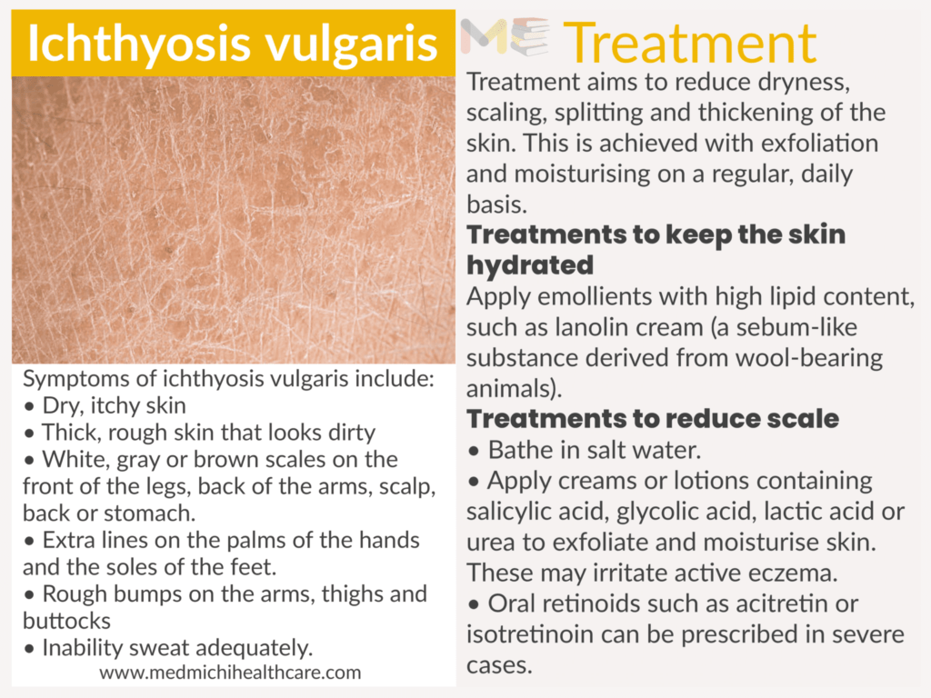 Ichthyosis vulgaris ​