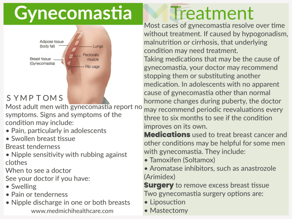 Gynecomastia 