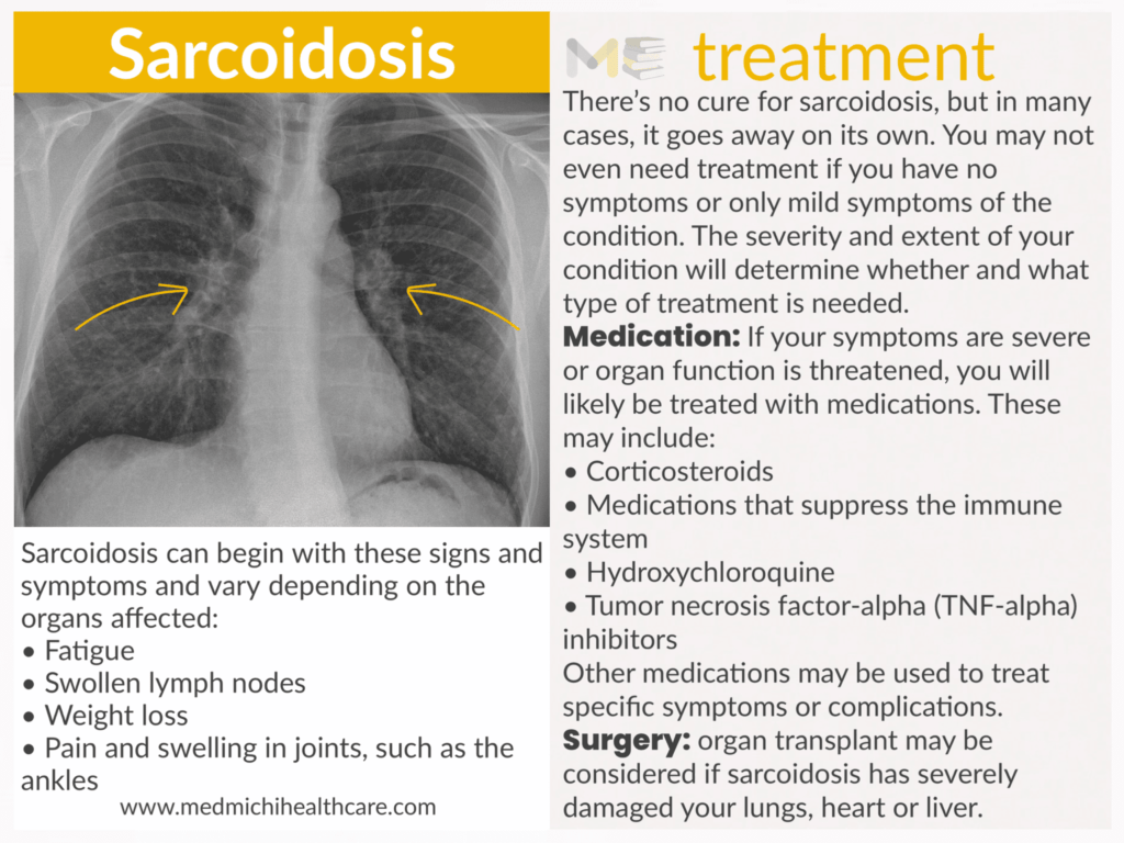 Sarcoidosis 