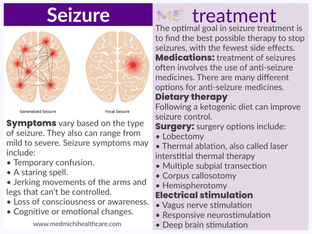 Seizure 