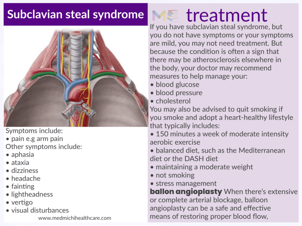 Subclavian steal syndrome ​
