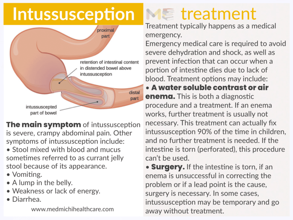 Intussusception 