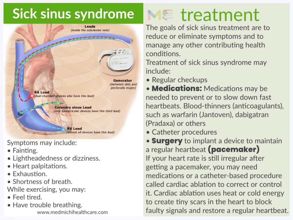 Sick sinus syndrome 