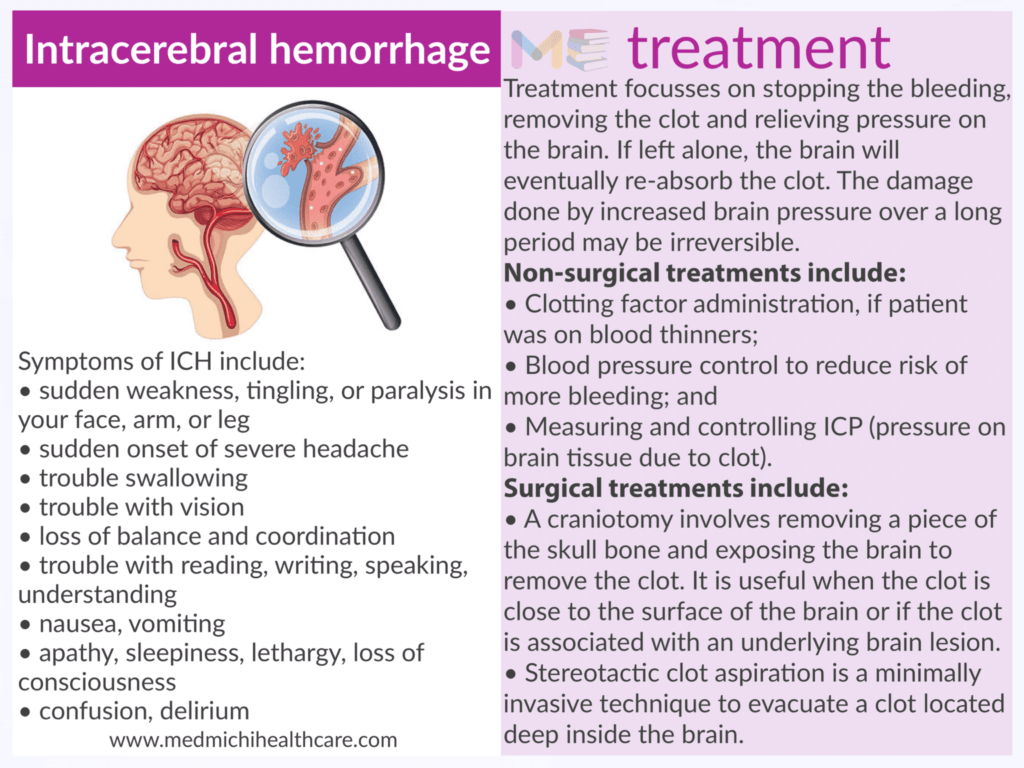 Intracerebral hemorrhage ​