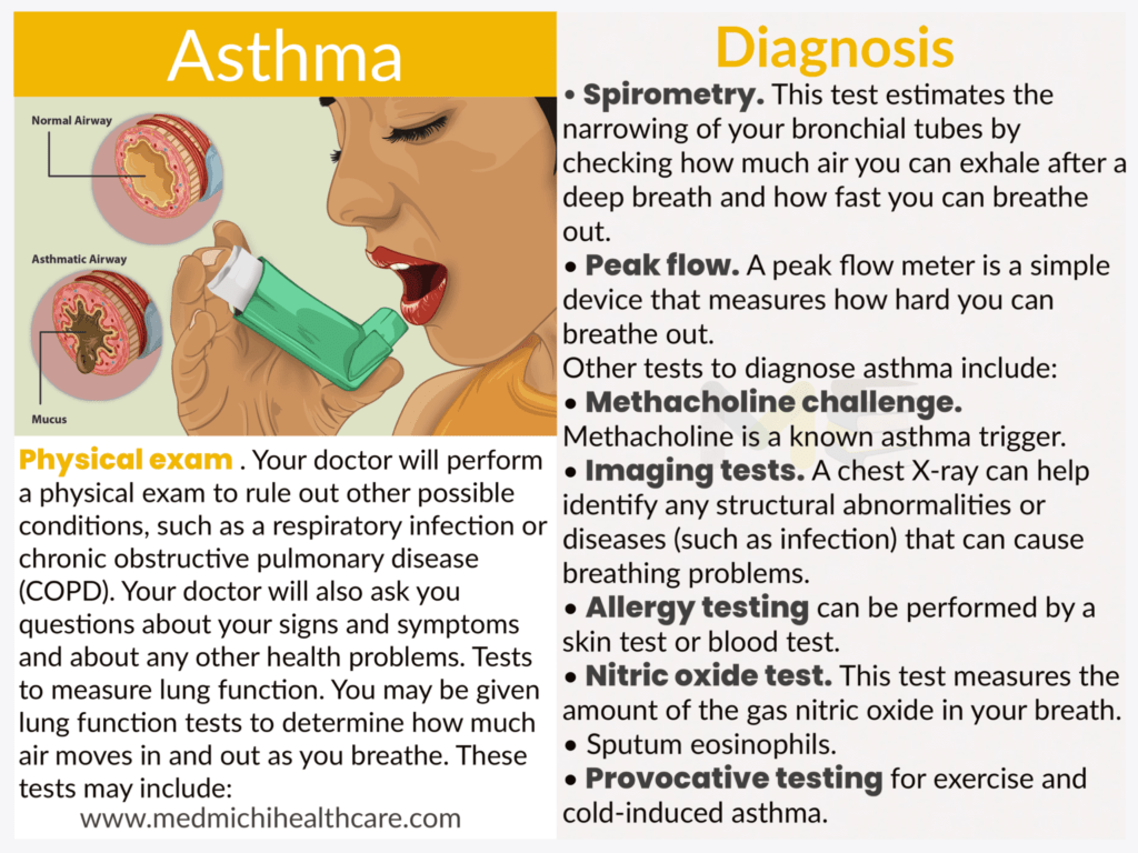 Asthma 