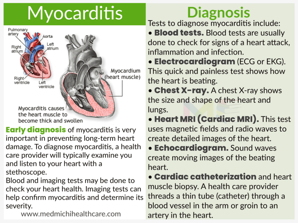 Myocarditis 