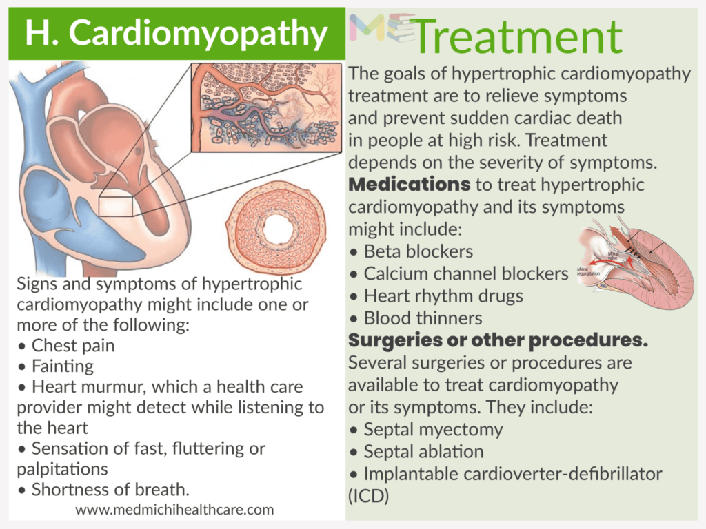 Hypertrophic cardiomyopathy ​