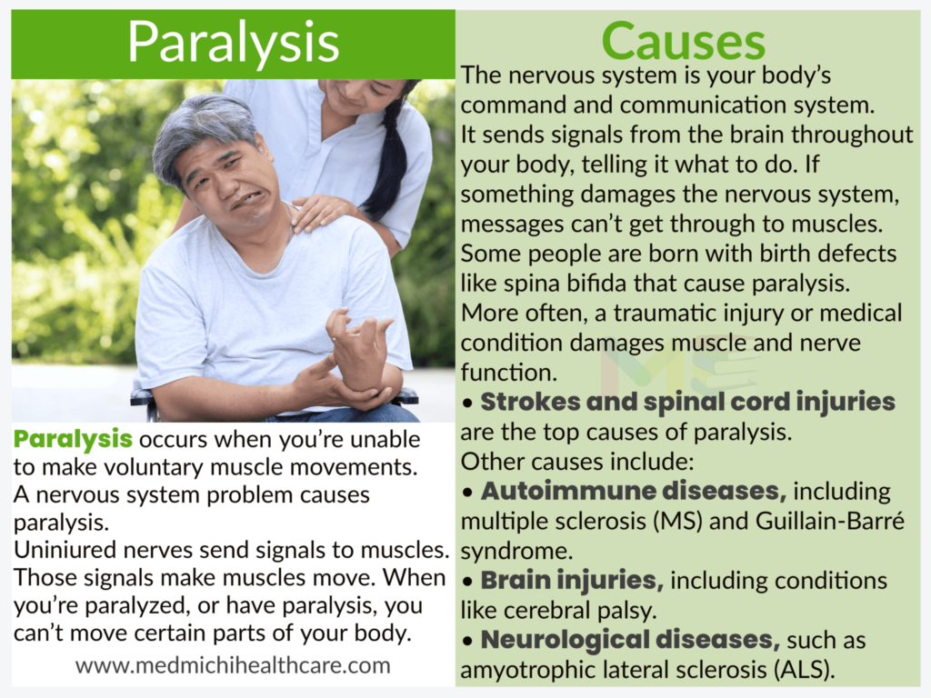 All Disease Causes Short Notes 17 Paralysis