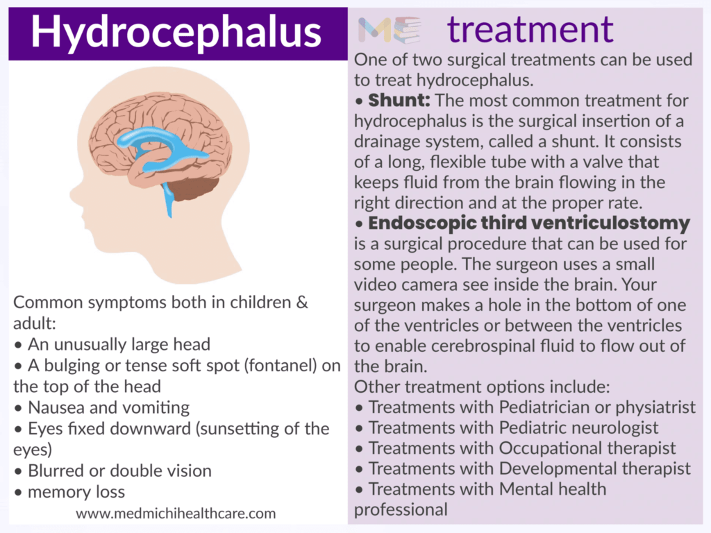 Hydrocephalus 
