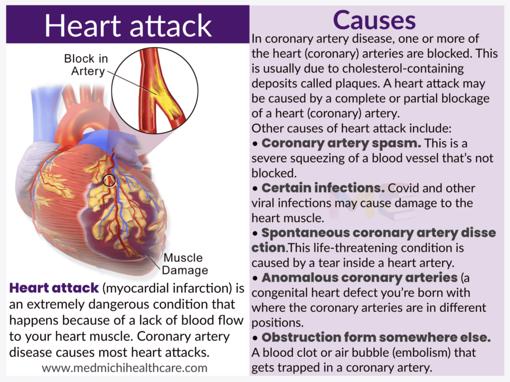 All Disease Causes Short Notes 23 Heart attack