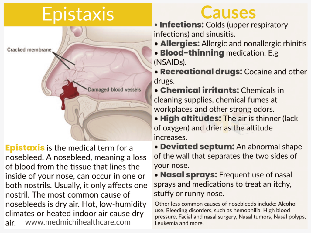 All Disease Causes Short Notes 26 Epistaxis