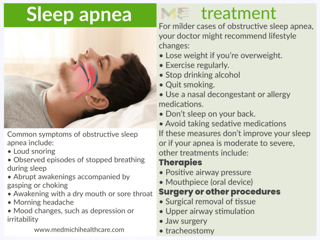 Sleep apnea 