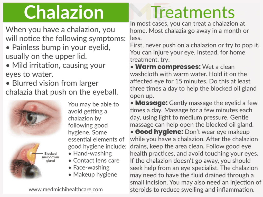 Chalazion 