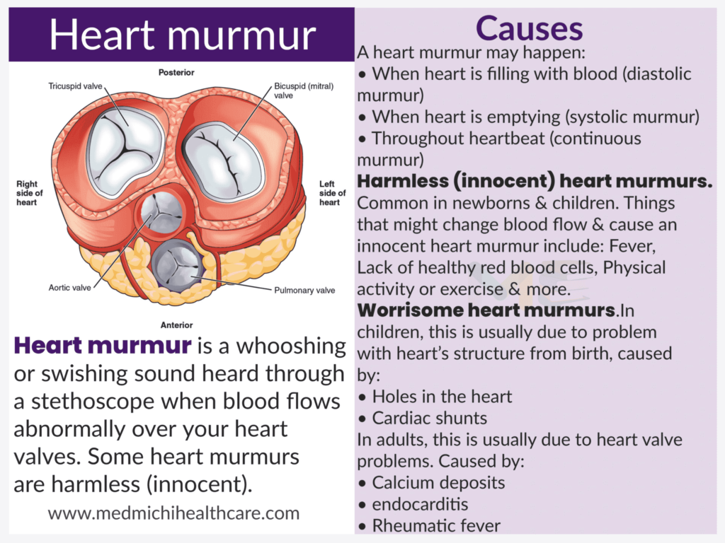 All Disease Causes Short Notes 11 Heart murmurs