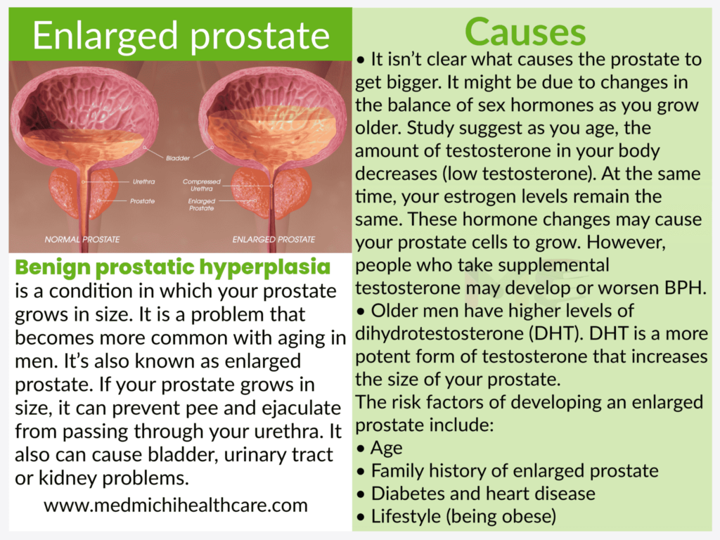 All Disease Causes Short Notes 33 Benign prostatic hyperplasia