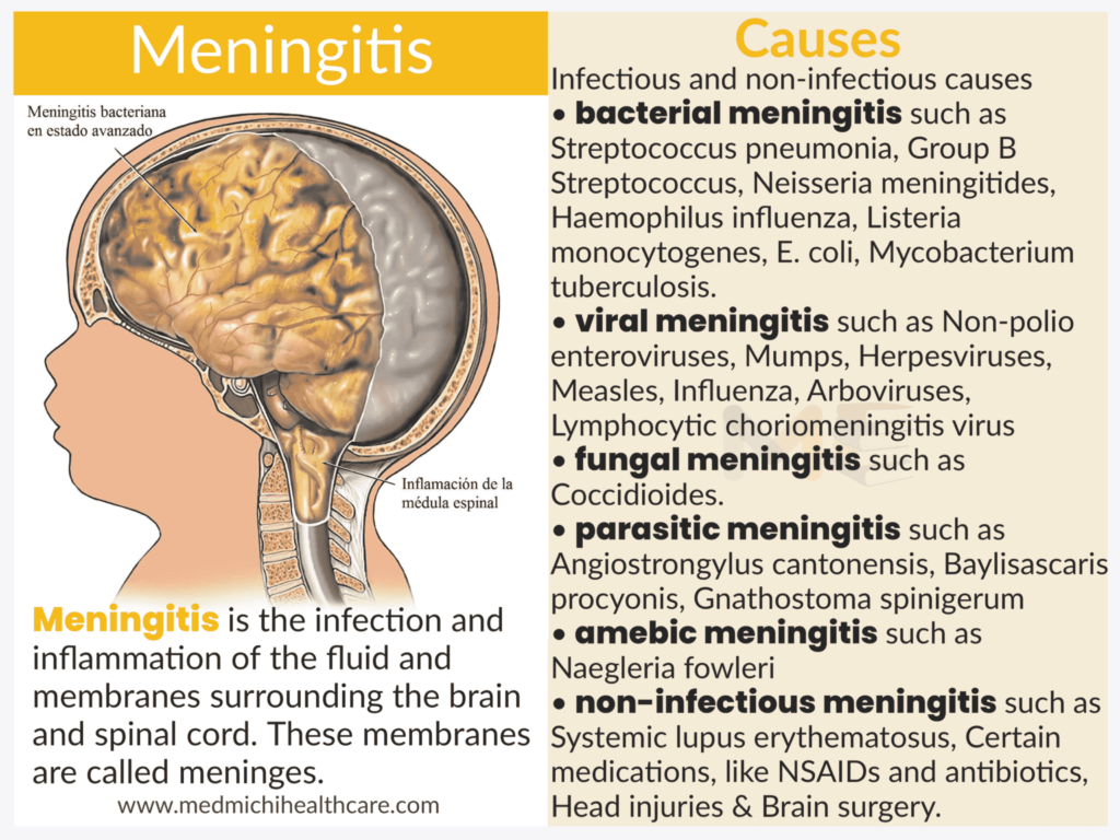 All Disease Causes Short Notes 30 Meningitis