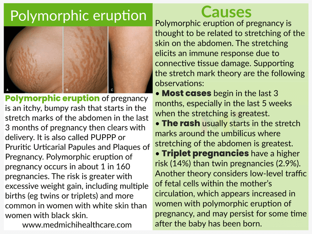 All Disease Causes Short Notes 35 Polymorphic eruption of pregnancy