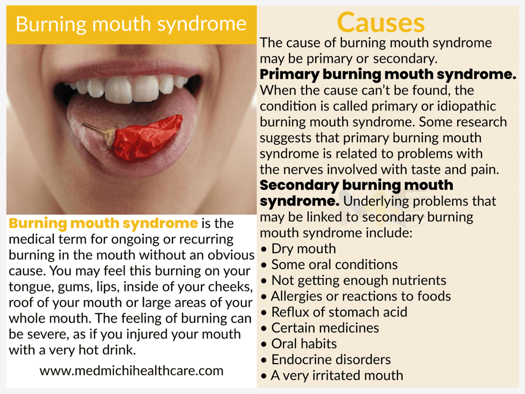 All Disease Causes Short Notes 36 Burning mouth syndrome