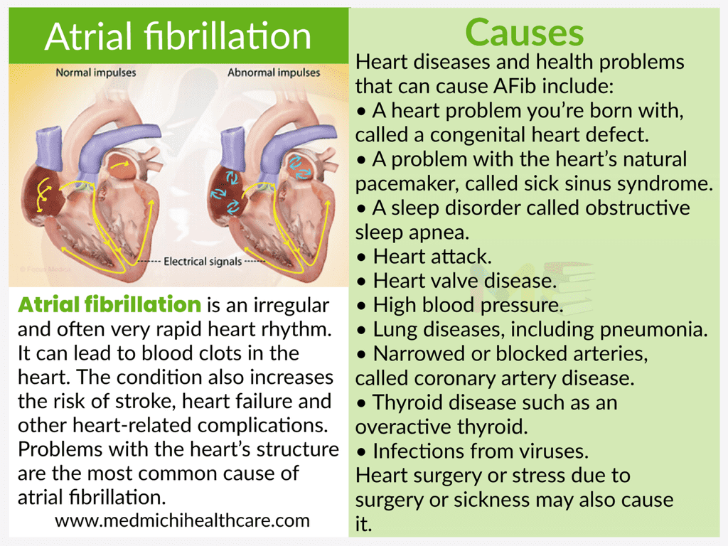 All Disease Causes Short Notes 10 Atrial fibrillation