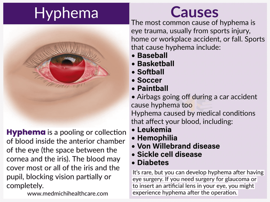 All Disease Causes Short Notes 38 9ee84dfb 0186 4512 ab3b cfa0ebabca63 compressed 1