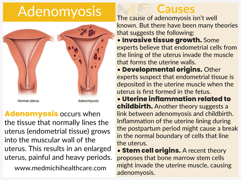 All Disease Causes Short Notes 13 5f7163e1 e060 4914 a6da 9ccc26f68471 compressed 1