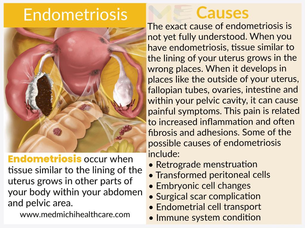 All Disease Causes Short Notes 21 5c370f36 e16f 4259 9fc6 c0ab81e1d11e compressed 1