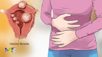 Abnormal uterine bleeding