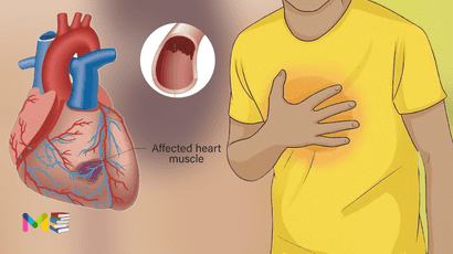 Heart failure