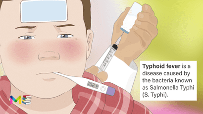Typhoid fever