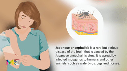 Japanese encephalitis