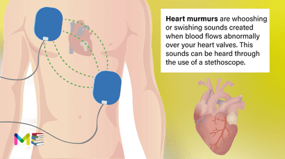 Heart murmurs