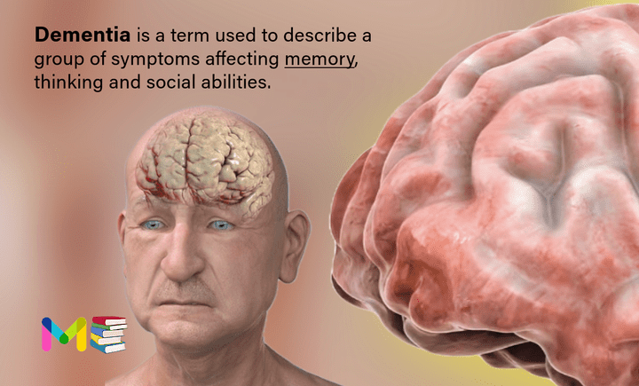 Dementia 