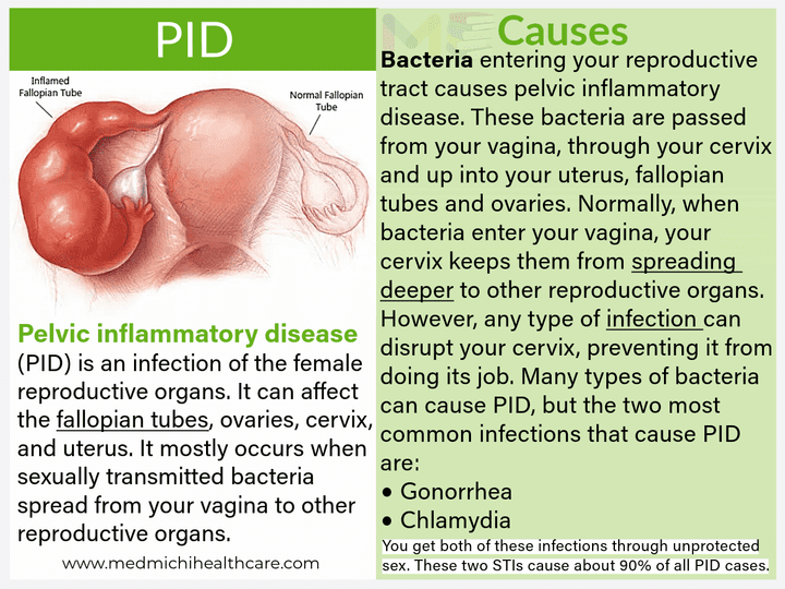 All Disease Causes Short Notes 8 Pelvic inflammatory disease