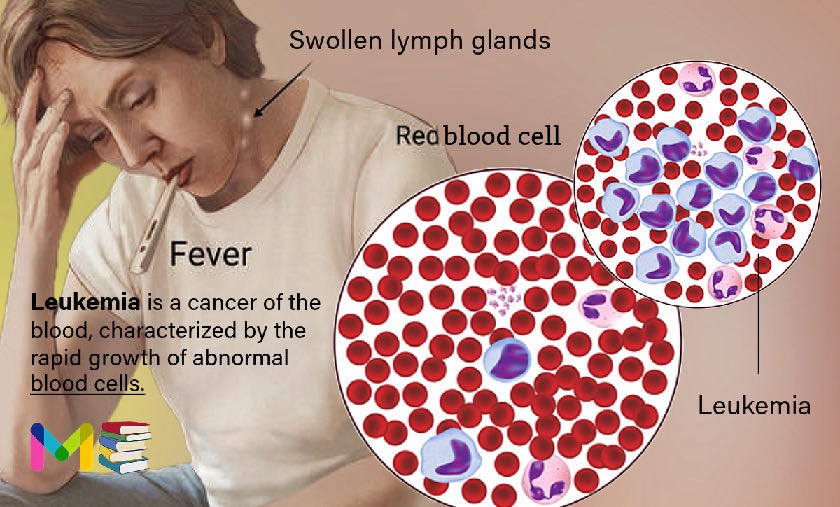 What is leukemia