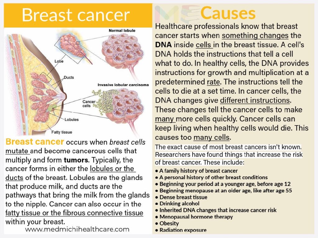 All Disease Causes Short Notes 3 Breast cancer causes